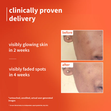 1% Vitamin C Ultra-Light-Glow Boosting Gel Cream with Alpha Arbutin