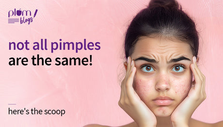 Types of pimples and their easy fixes